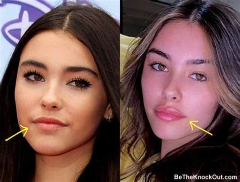 does madison beer have a boob job|Madison Beer: Before and After Surgery